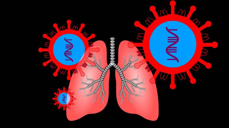 depiction of lungs infected with SARS-Cov-2