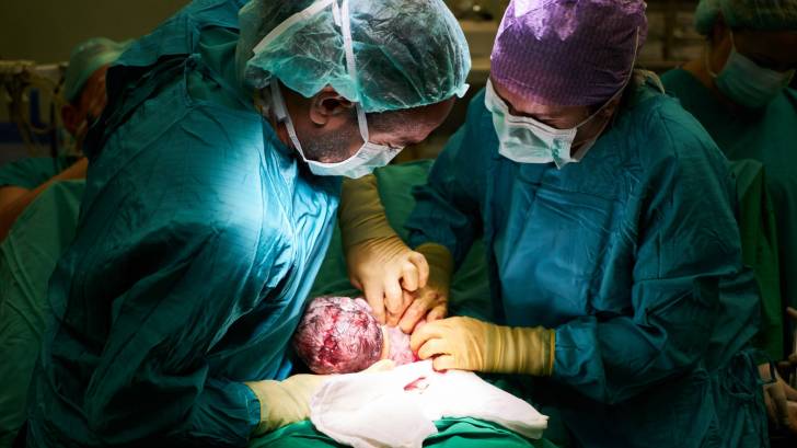 new born baby being born