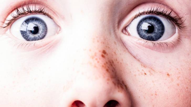 blue eyed freckled surprise look