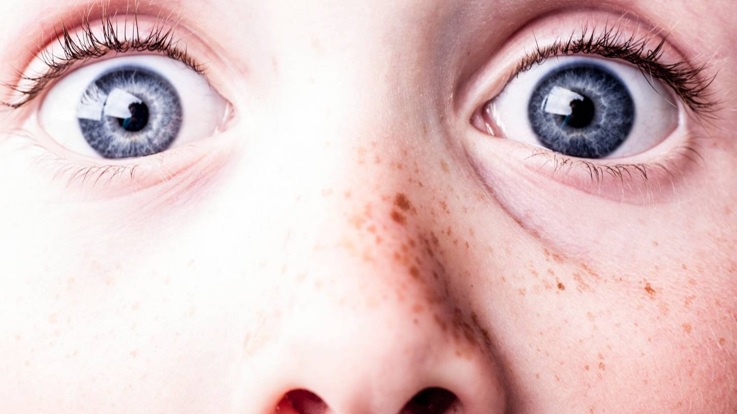 blue eyed freckled surprise look