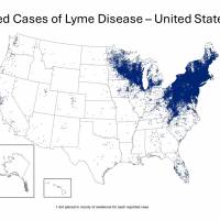 Lyme disease vaccine