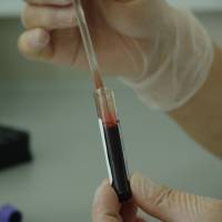 blood test