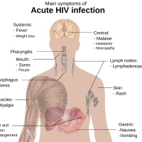 HIV vaccines April 2023